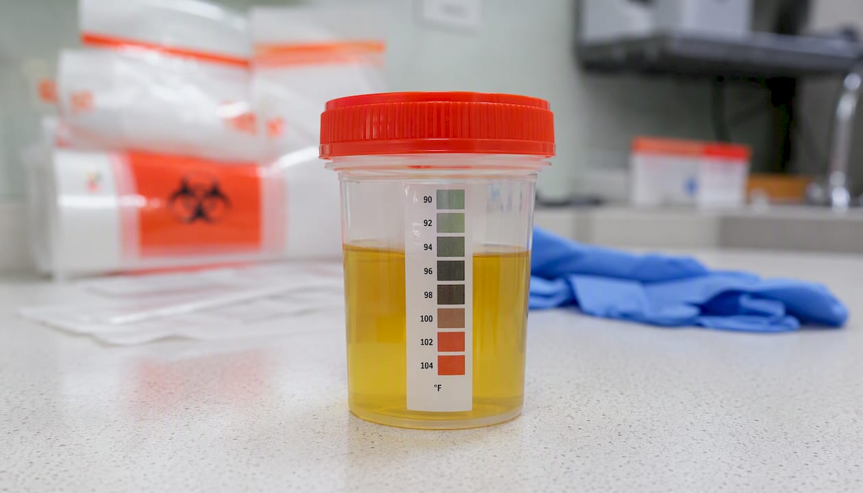 Temperature strip on urine collection cup
