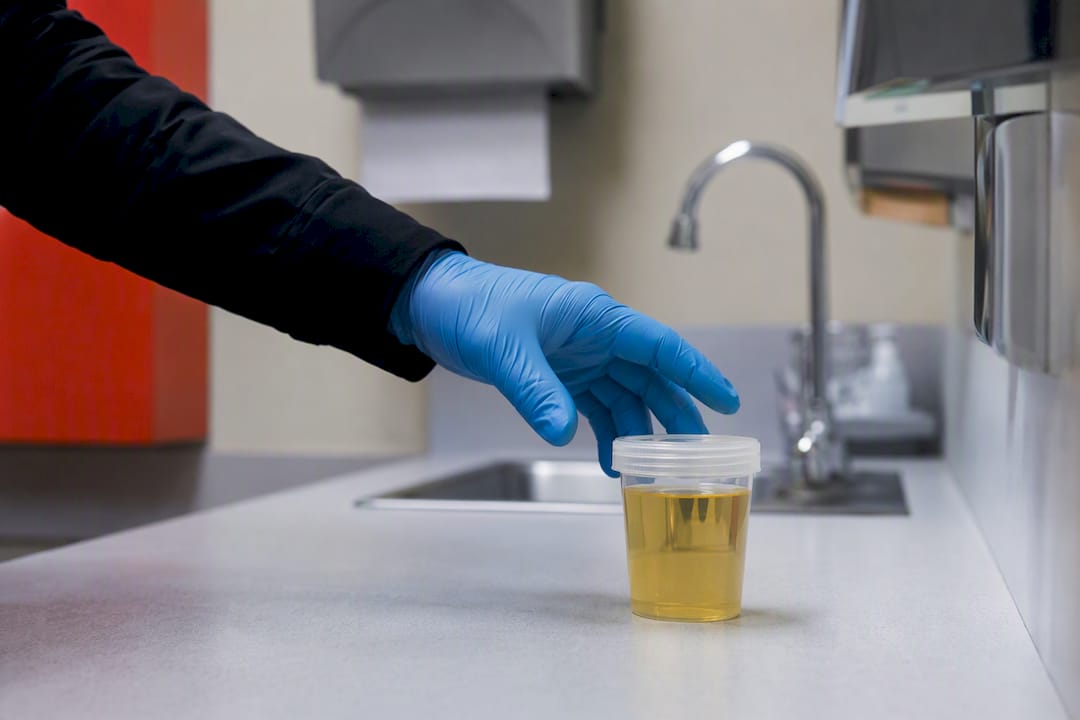 Gloved hand holding urine sample cup
