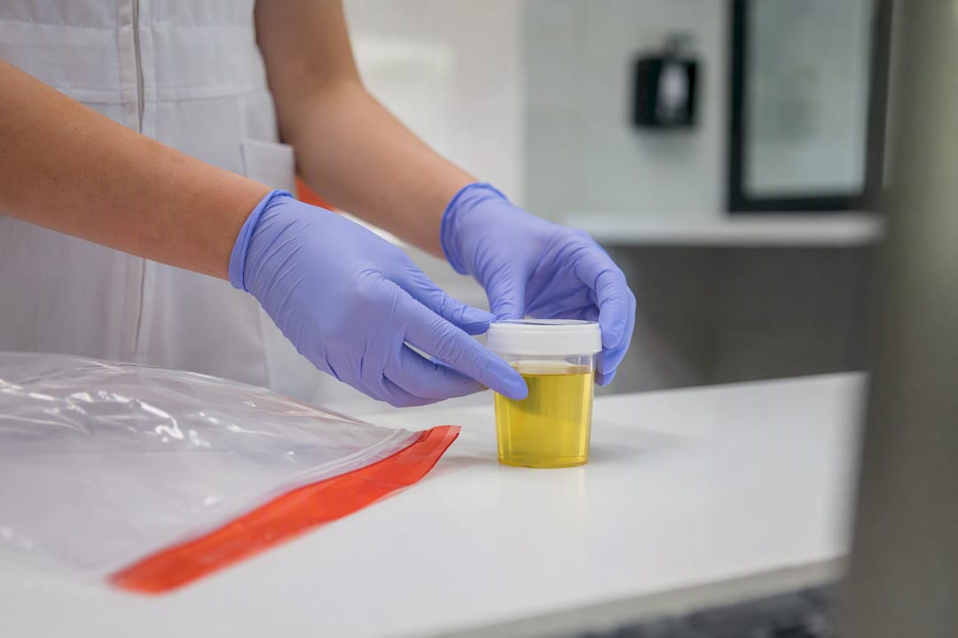 Urine sample cup being capped in clinical setting