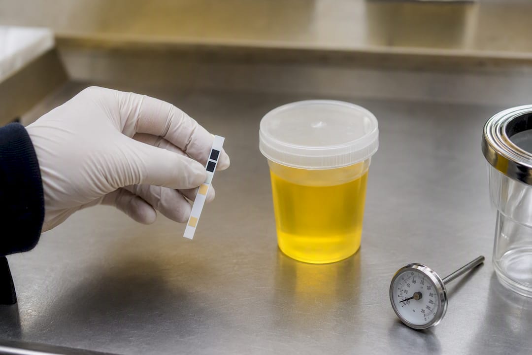 Hand checking synthetic urine temperature strip