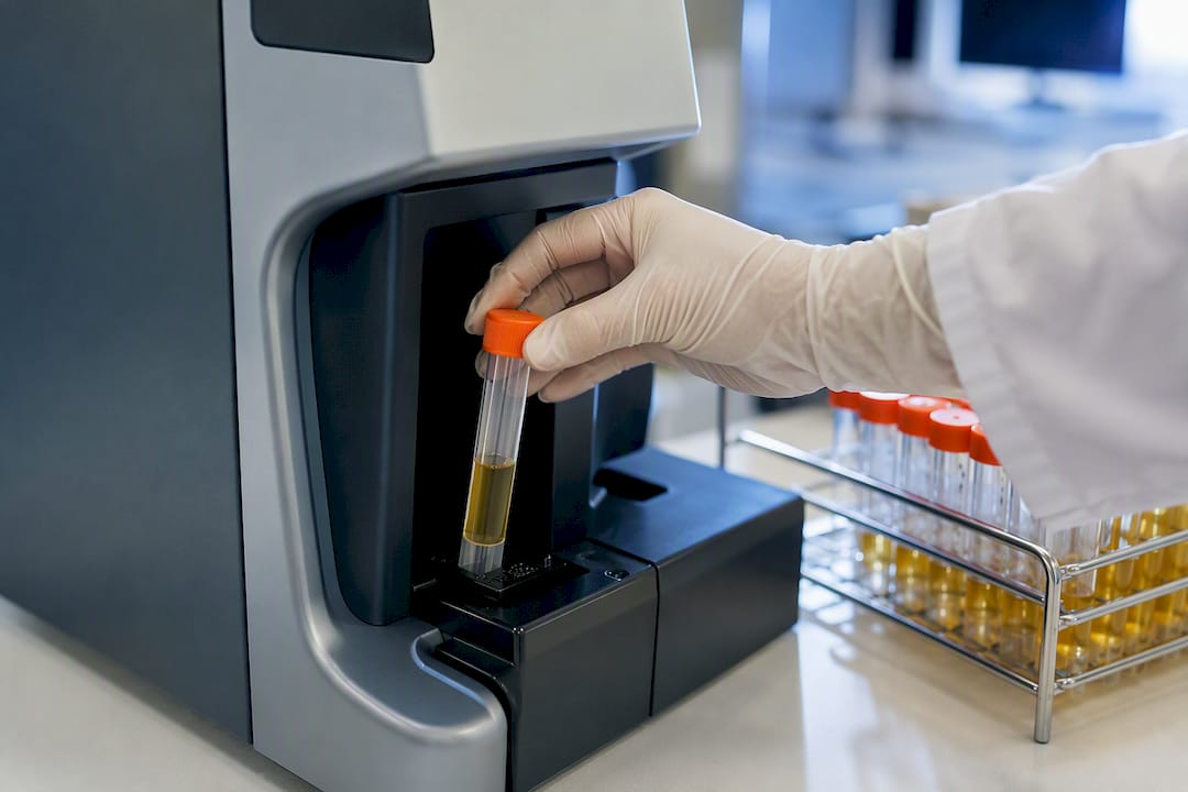 Laboratory analyzer checking a urine specimen
