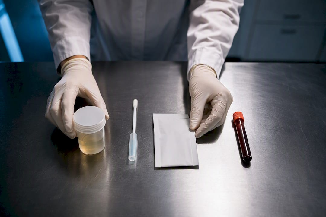 Four workplace drug testing specimen types