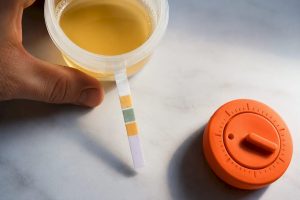 Sample temperature strip showing warm range