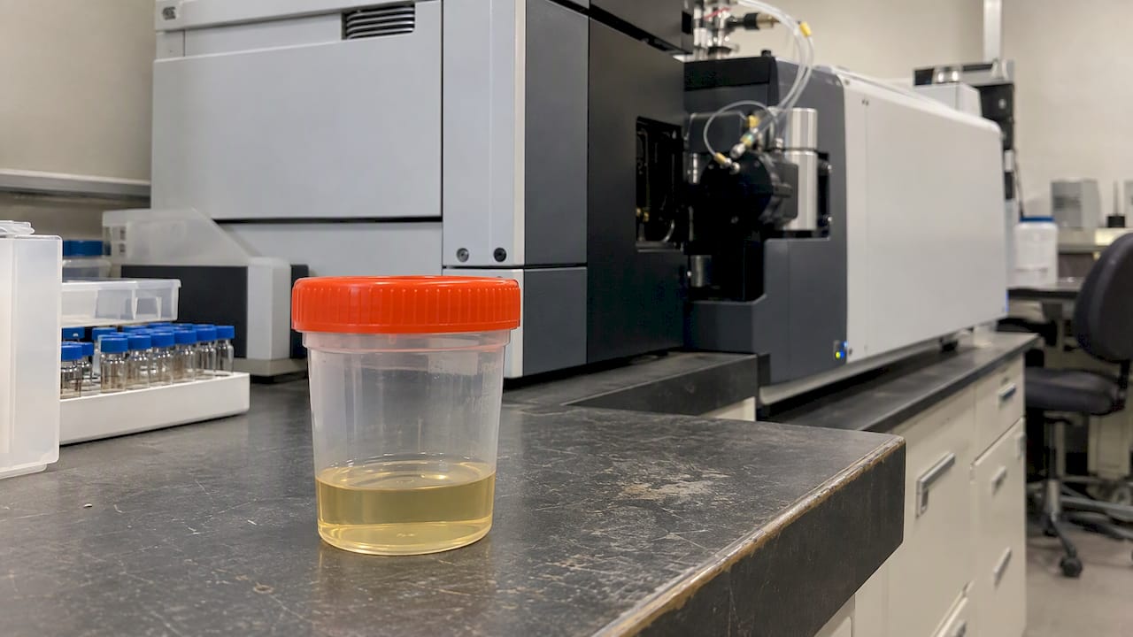 Urine specimen beside laboratory testing equipment