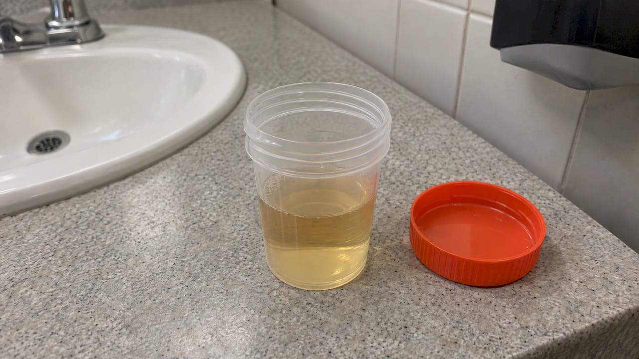 Specimen cup on a collection restroom counter
